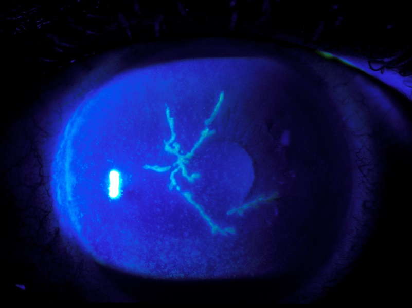 fluoresceina