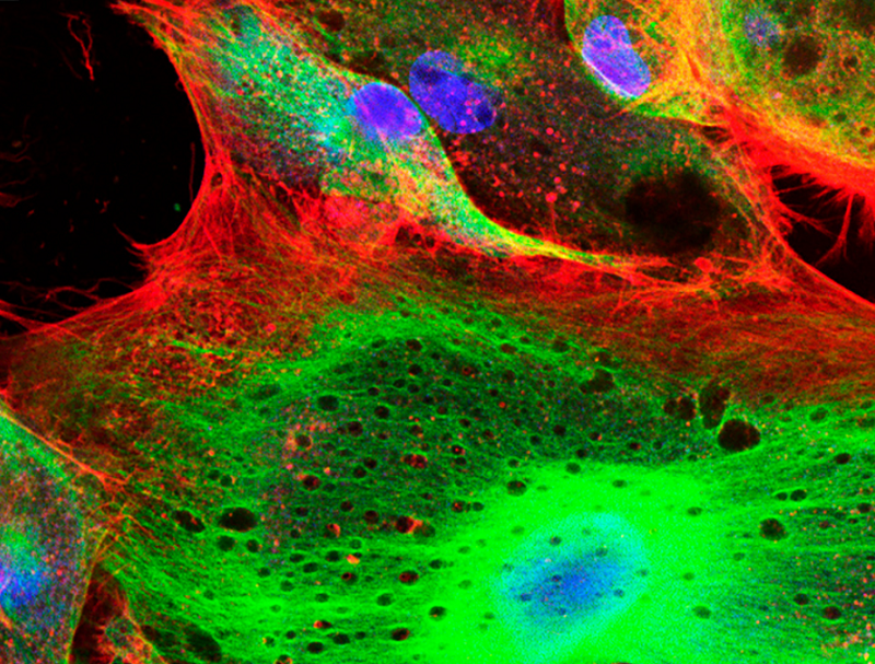 proteine fluorescenti