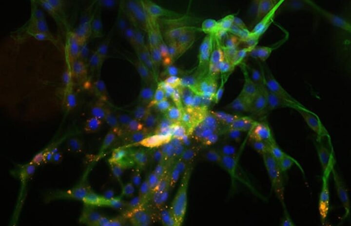RNA interference